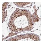 Atlas Antibodies Anti-SWI5 Antibody