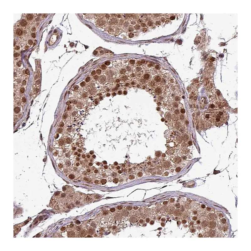Atlas Antibodies Anti-SWI5 Antibody