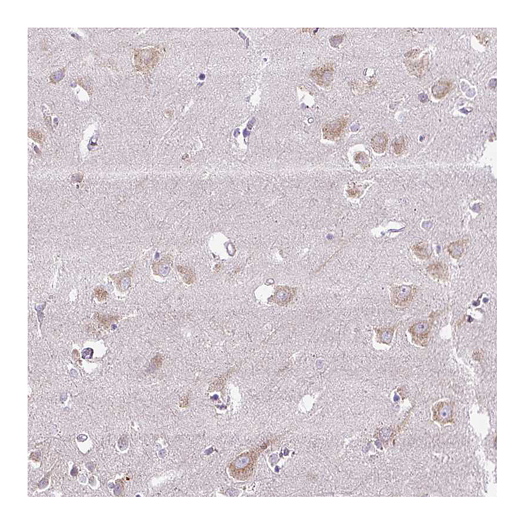 Atlas Antibodies Anti-SYBU Antibody