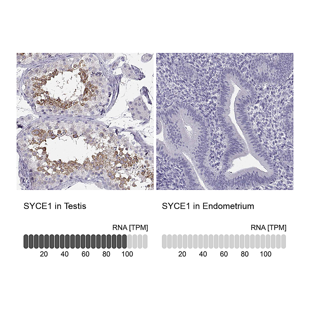Atlas Antibodies Anti-SYCE1 Antibody