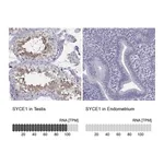 Atlas Antibodies Anti-SYCE1 Antibody