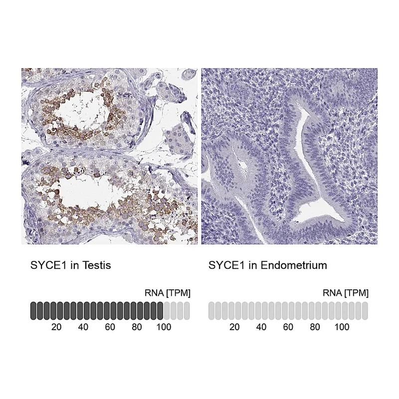 Atlas Antibodies Anti-SYCE1 Antibody
