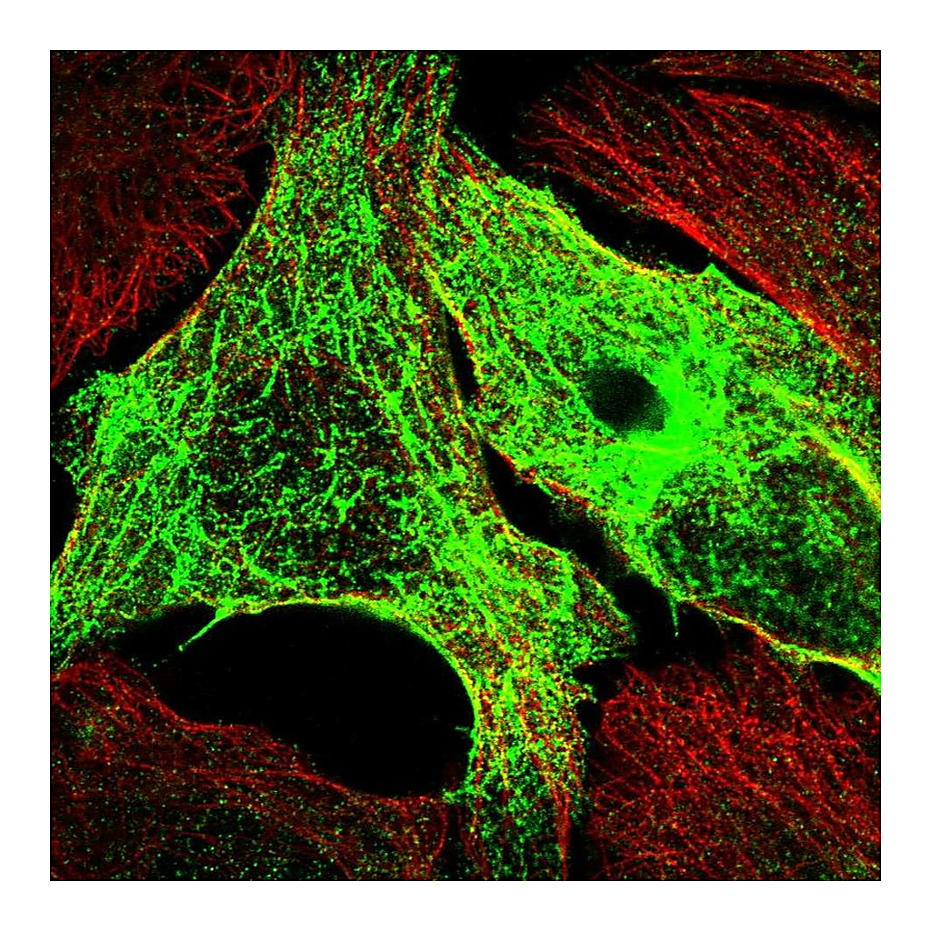 Atlas Antibodies Anti-SYCE1L Antibody