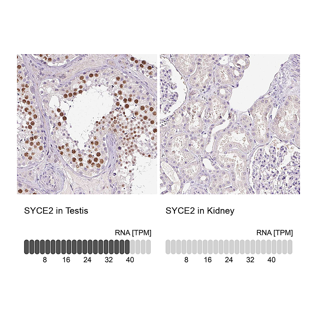 Atlas Antibodies Anti-SYCE2 Antibody