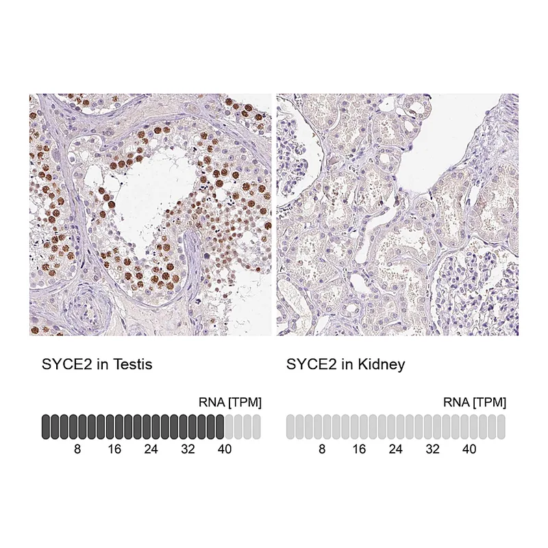 Atlas Antibodies Anti-SYCE2 Antibody