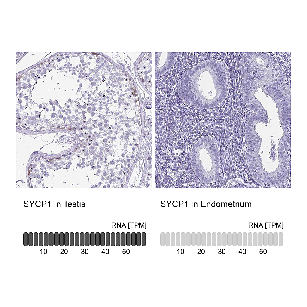 Atlas Antibodies Anti-SYCP1 Antibody