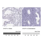 Atlas Antibodies Anti-SYCP1 Antibody