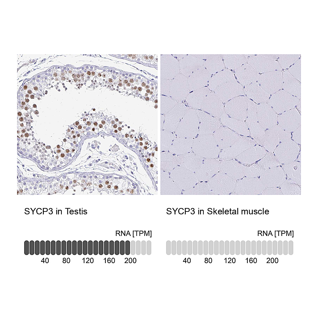Atlas Antibodies Anti-SYCP3 Antibody
