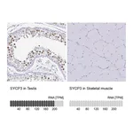 Atlas Antibodies Anti-SYCP3 Antibody