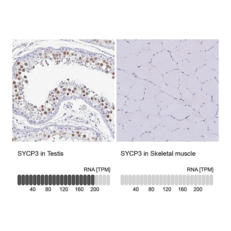 Atlas Antibodies Anti-SYCP3 Antibody