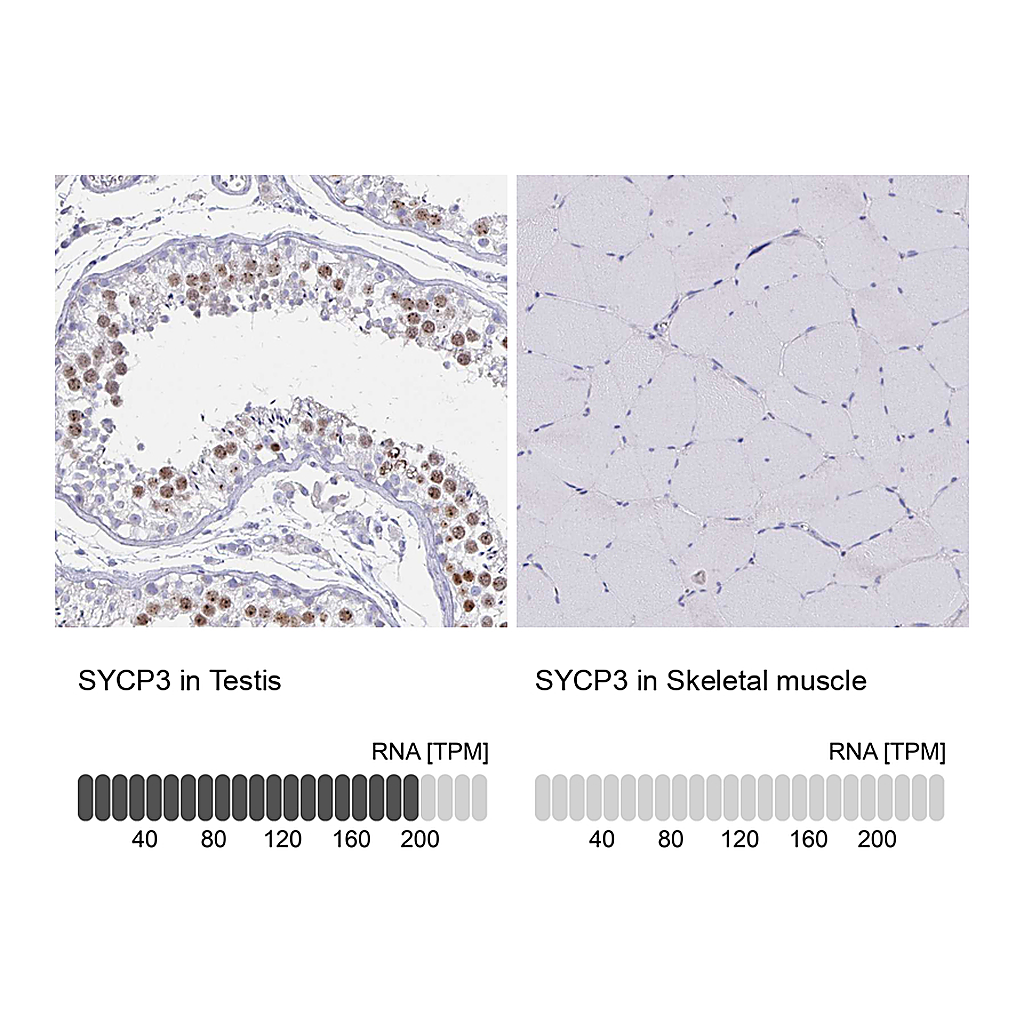 Atlas Antibodies Anti-SYCP3 Antibody