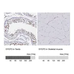 Atlas Antibodies Anti-SYCP3 Antibody