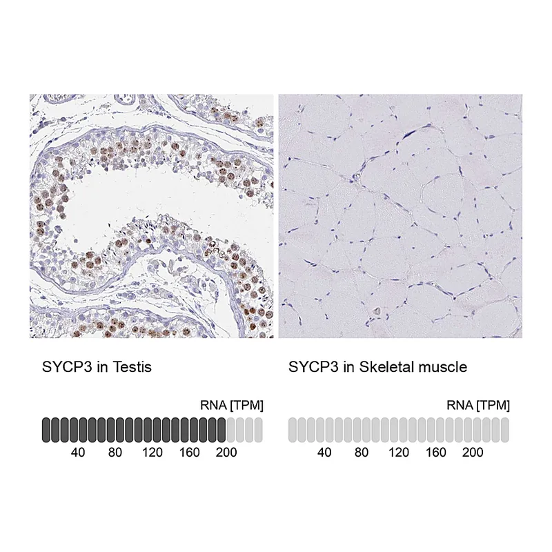 Atlas Antibodies Anti-SYCP3 Antibody