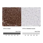 Atlas Antibodies Anti-SYK Antibody