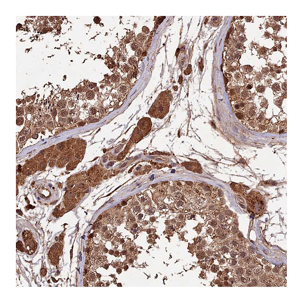 Atlas Antibodies Anti-SYMPK Antibody