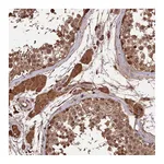Atlas Antibodies Anti-SYMPK Antibody