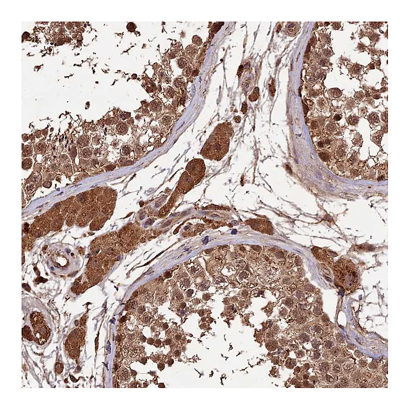 Atlas Antibodies Anti-SYMPK Antibody