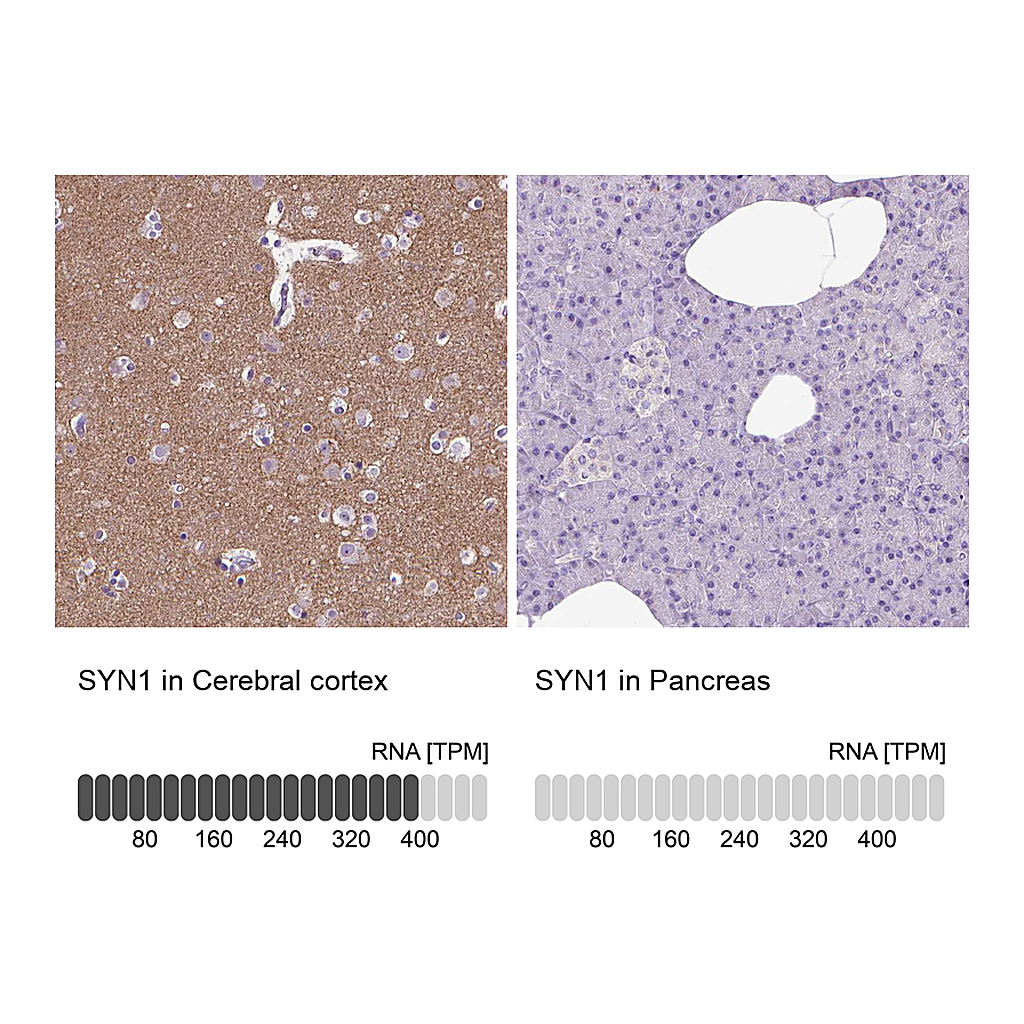 Atlas Antibodies Anti-SYN1 Antibody