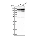 Atlas Antibodies Anti-SYMPK Antibody