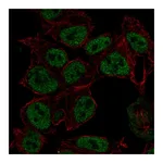 Atlas Antibodies Anti-SYN2 Antibody