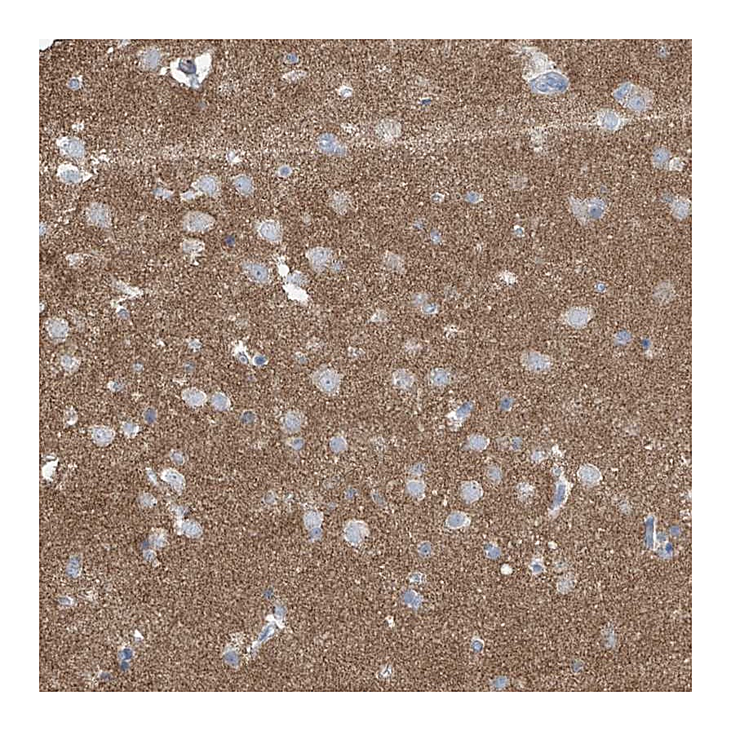Atlas Antibodies Anti-SYN3 Antibody