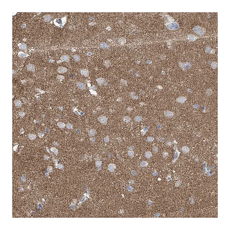 Atlas Antibodies Anti-SYN3 Antibody
