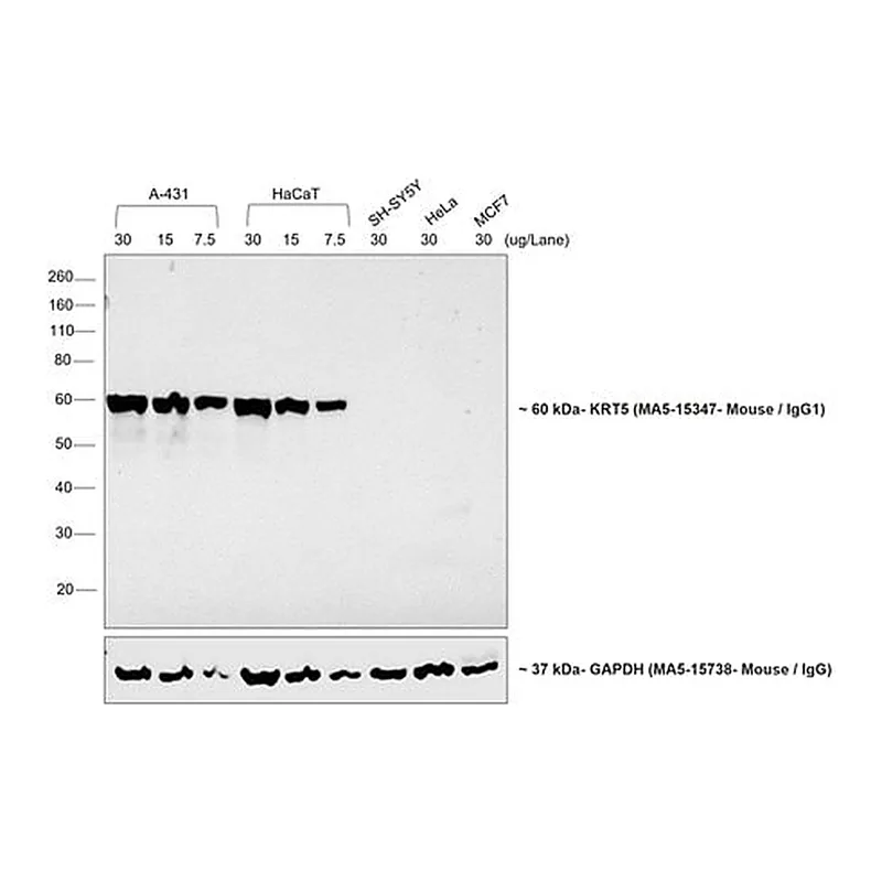 Thermo Fisher Scientific Goat anti-Mouse IgG1 Cross-Adsorbed Secondary Antibody, HRP