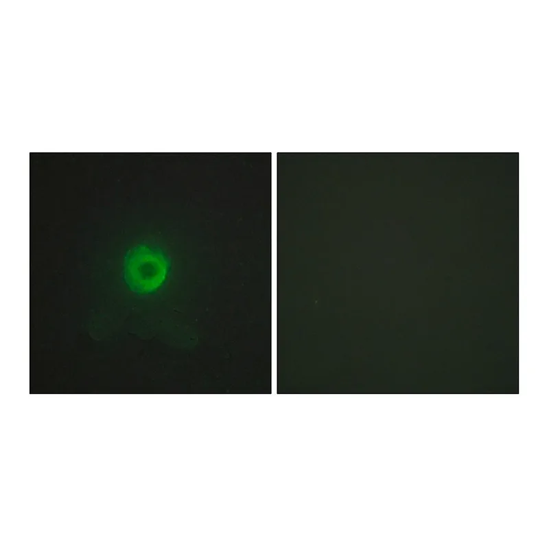 Merck Anti-TNF Receptor II, antibody produced in rabbit