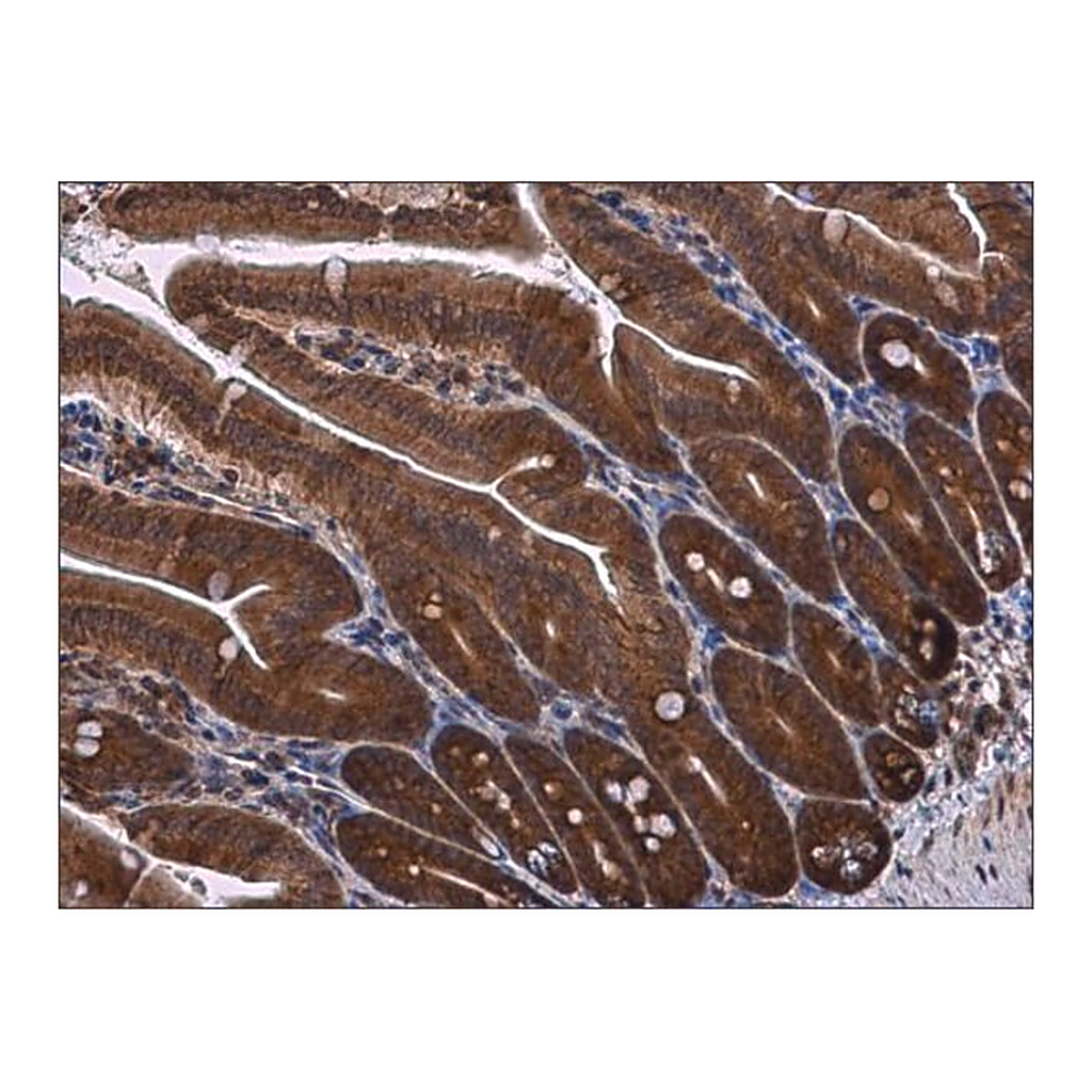 Merck Anti-RPS3 antibody produced in rabbit
