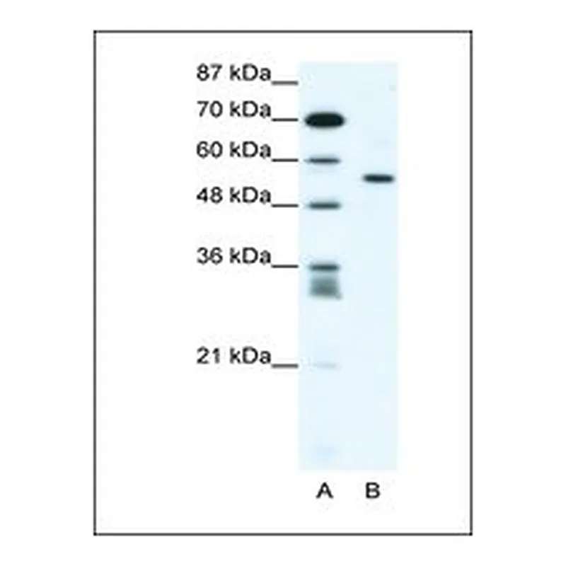 Merck Anti-RUNX2