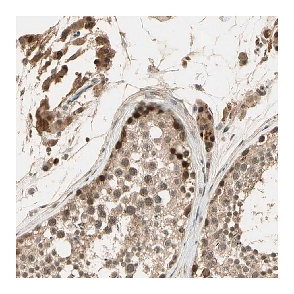 Merck Anti-GMEB2 antibody produced in rabbit