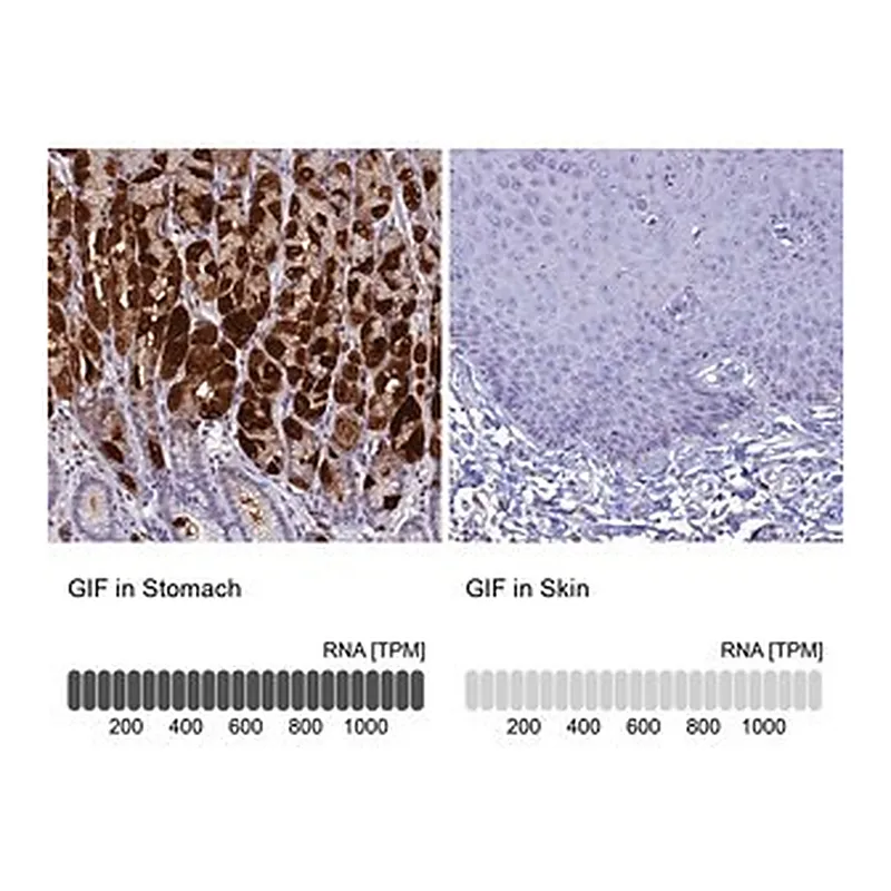 Merck ANTI-GIF