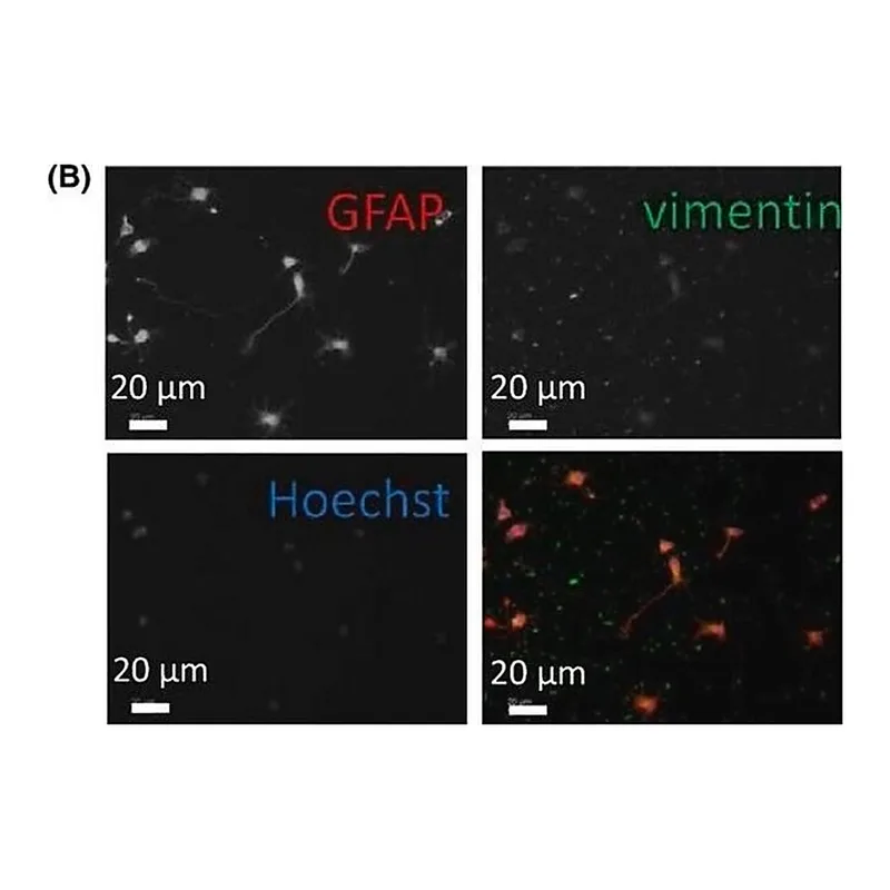 Merck Anti-Vimentin antibody produced in rabbit