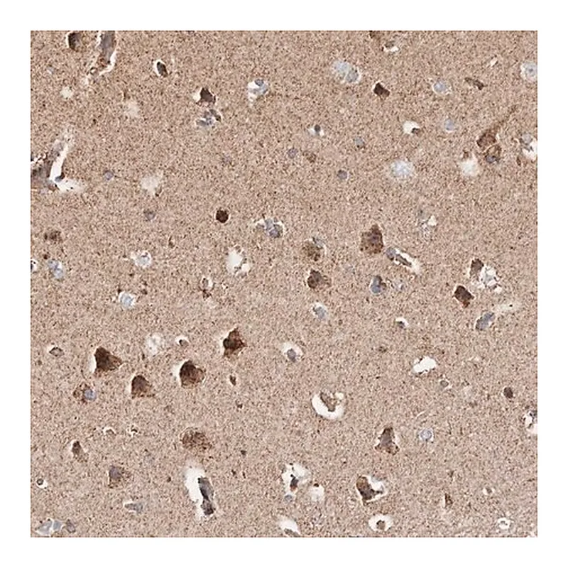Merck Anti-PRKACB antibody produced in rabbit