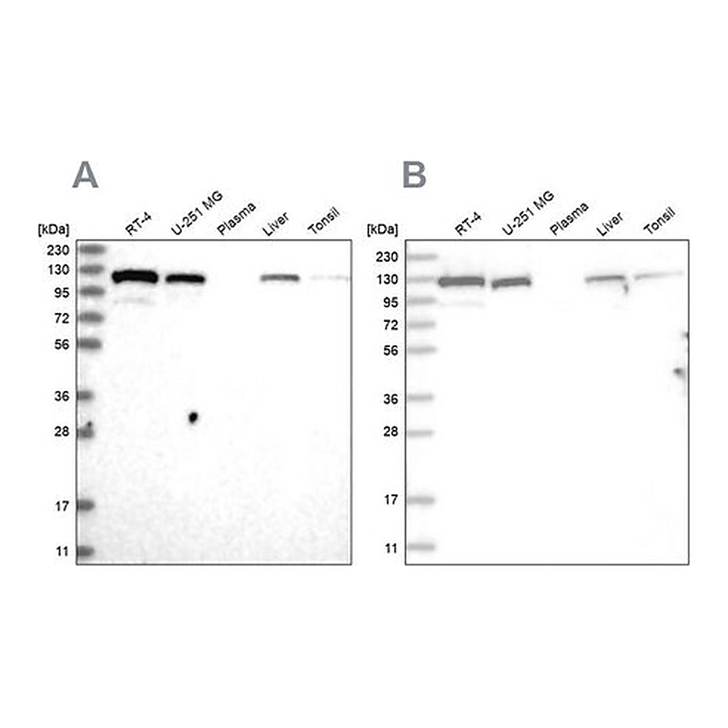 Merck Anti-RAI14 antibody produced in rabbit