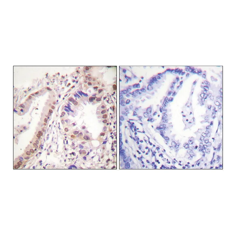 Merck Anti-Estrogen Receptor-alpha, C-Terminal antibody produced in rabbit