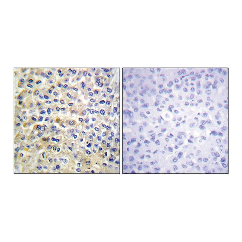 Merck Anti-EGFR antibody produced in rabbit