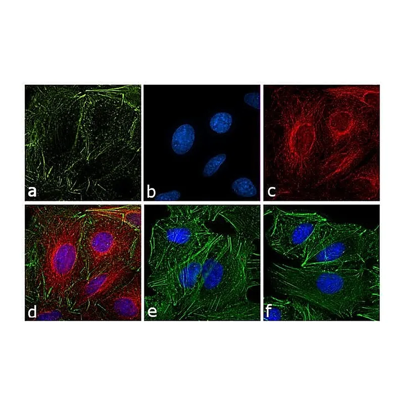 Thermo Fisher Scientific Goat anti-Rat IgG (H+L) Secondary Antibody, TRITC