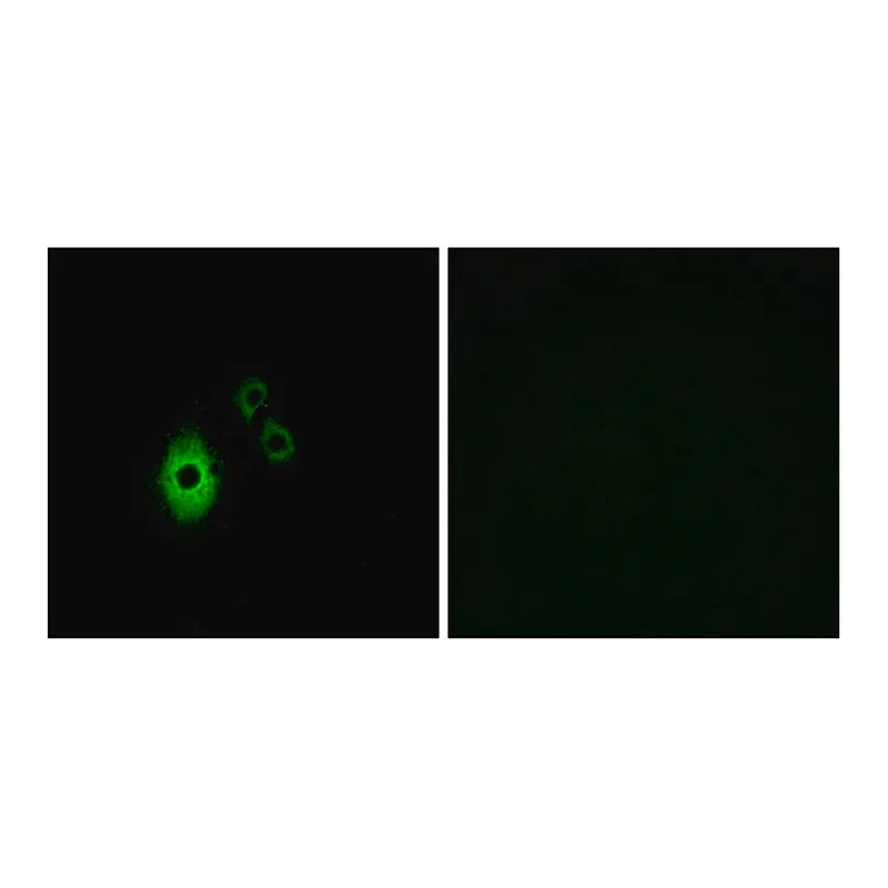 Merck Anti-KCNJ5 antibody produced in rabbit