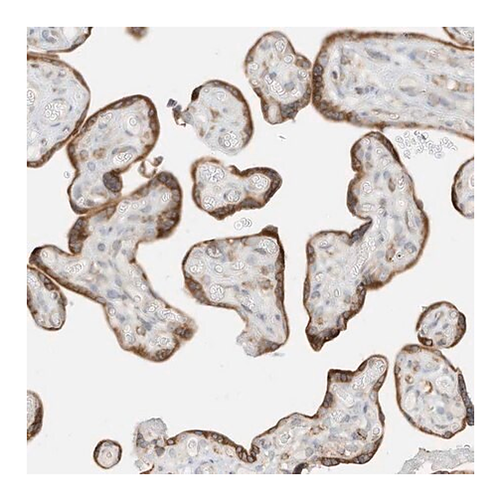 Merck Anti-STT3A antibody produced in rabbit