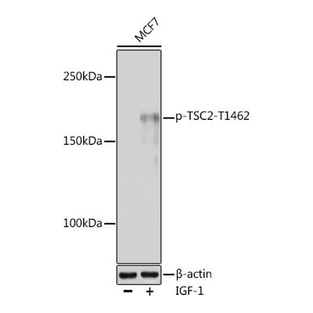 Merck Anti-Phospho-TSC2-T1462 antibody produced in rabbit