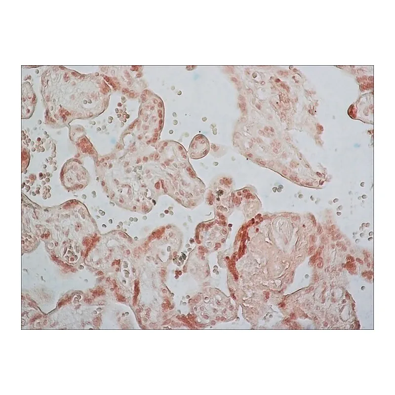 Merck Anti-Breast Cancer Resistance Protein antibody produced in rabbit