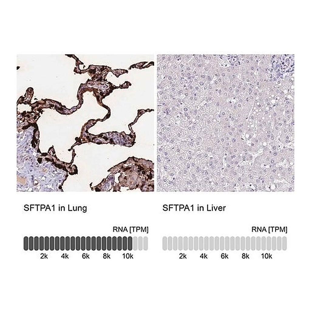 Merck Anti-SFTPA1 antibody produced in rabbit