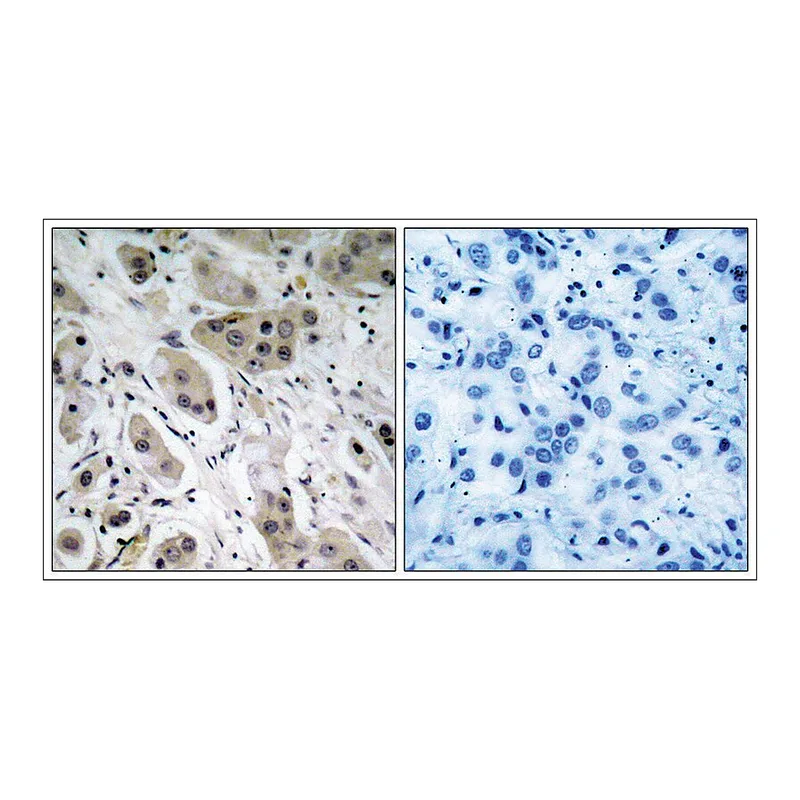 Merck Anti-phospho-AKT1 (pSer473) antibody produced in rabbit