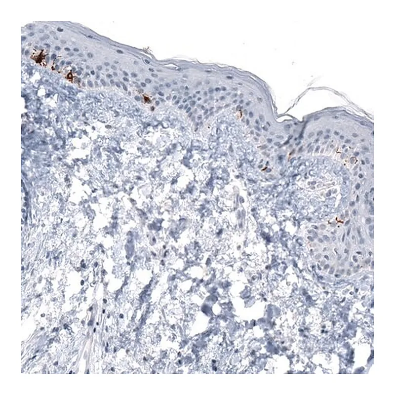 Merck Monoclonal Anti-TYRP1 antibody produced in mouse