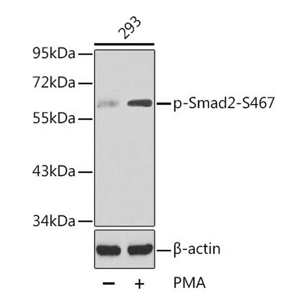 Merck Anti-Phospho-Smad2-S467 antibody produced in rabbit