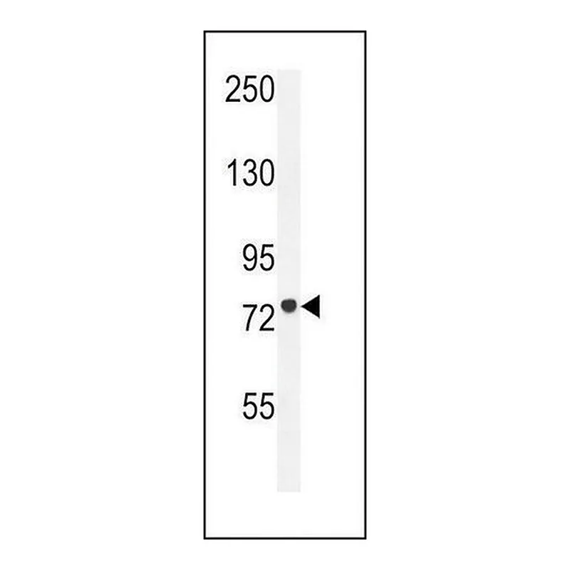 Merck ANTI-CPT1C(C-TERMINAL) antibody produced in rabbit