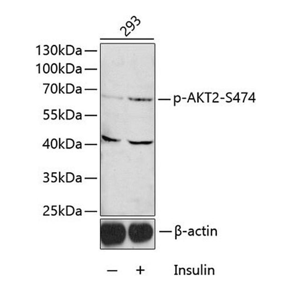 Merck Anti-Phospho-AKT2-S474 antibody produced in rabbit