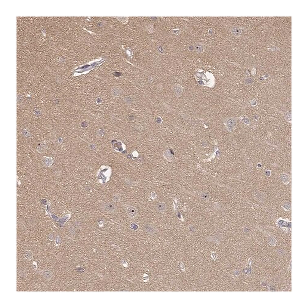 Merck Anti-MED12L antibody produced in rabbit