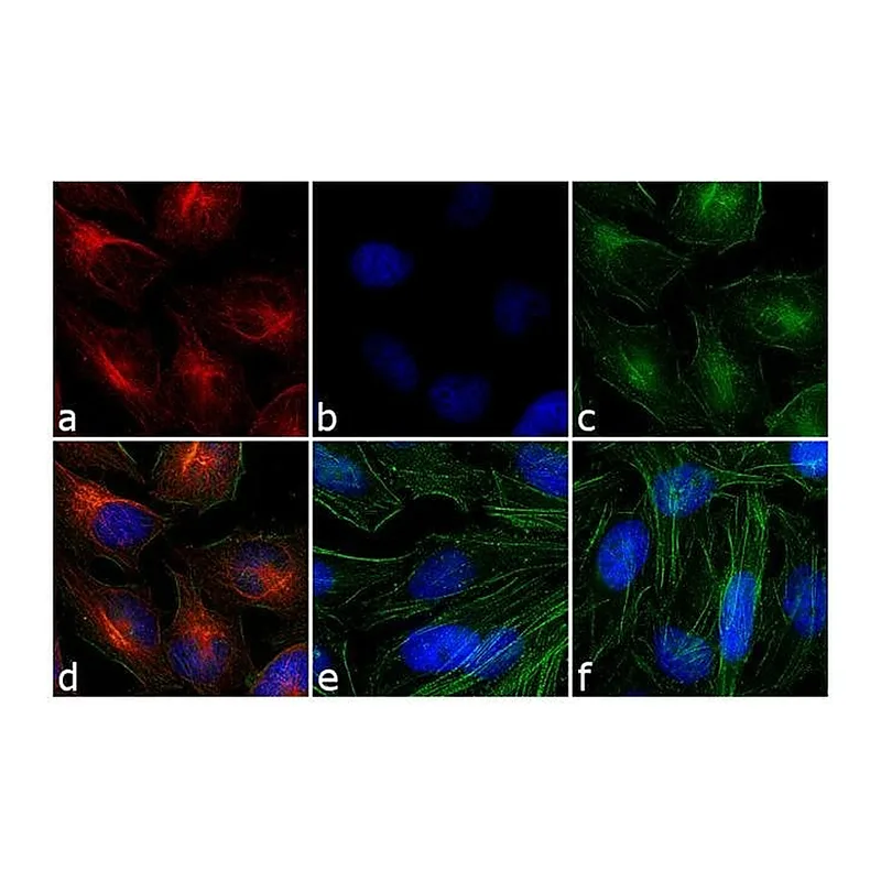 Thermo Fisher Scientific Goat anti-Mouse IgG (H+L) Secondary Antibody, Rhodamine
